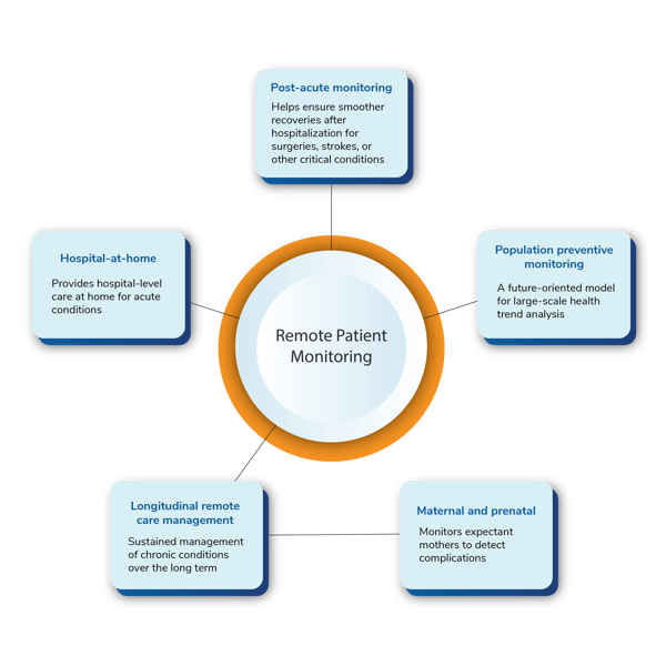 4 types of RPM