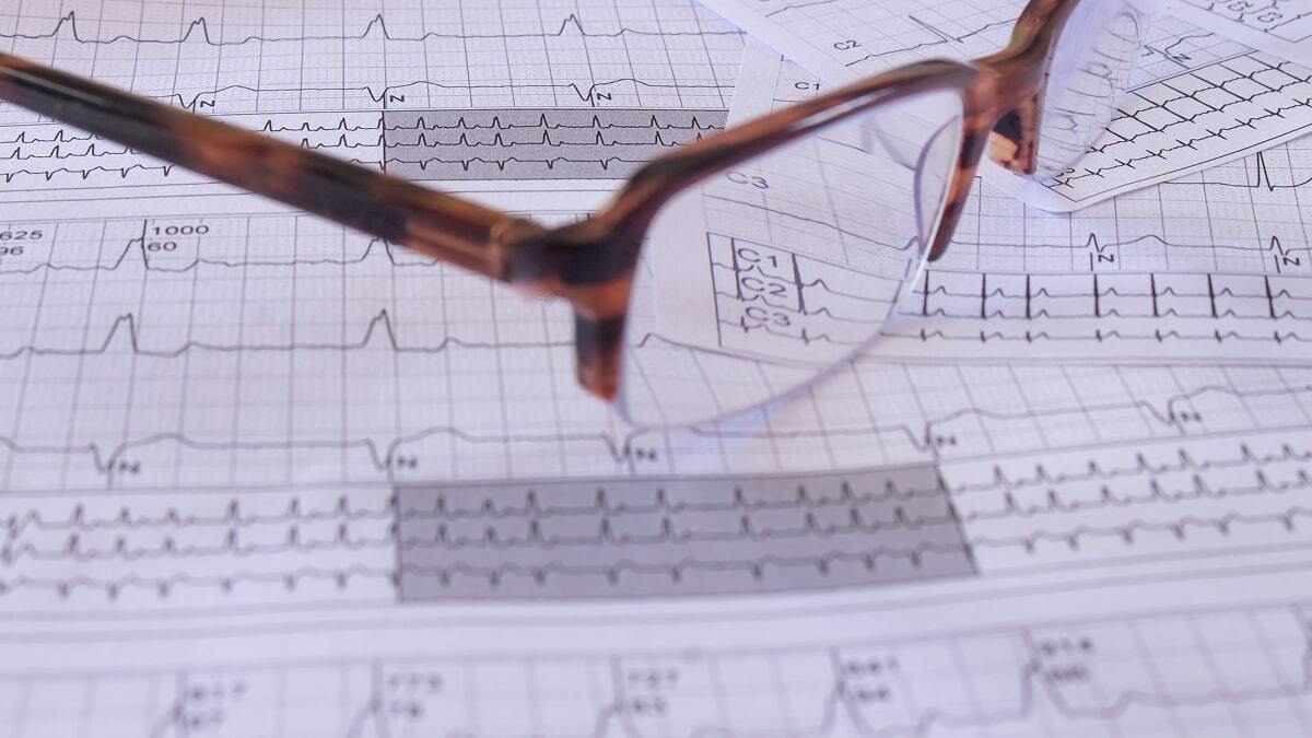 Rise of Atrial Fibrillation and Importance of Remote Care Management