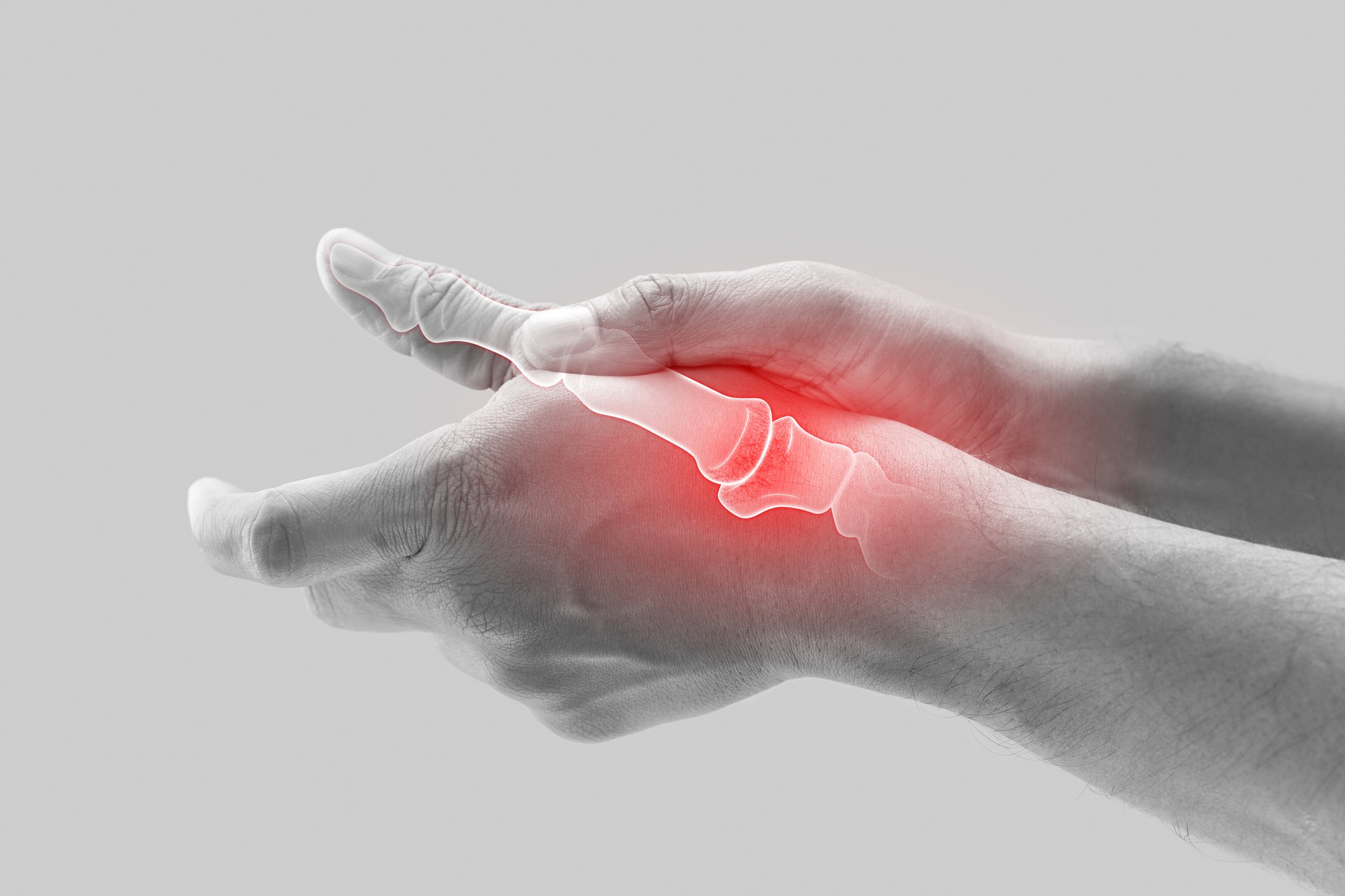Osteoarthritis & Rheumatoid Arthritis: Role of Remote Care Management